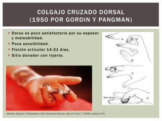 COLGAJO CRUZADO DORSAL
                    (1950 POR GORDIN Y PANGMAN)

 Dorso es poco satisfactorio por su espesor
  y maleabilidad.
 Poca sensibilidad.
 Flexión ar ticular 14 -21 días.
 Sitio donador con injer to.




Mathes, Stephen. Philadelphia, USA. Saunders Elseiver. 2da ed. Tomo 7. 2008. capitulo 170.
 