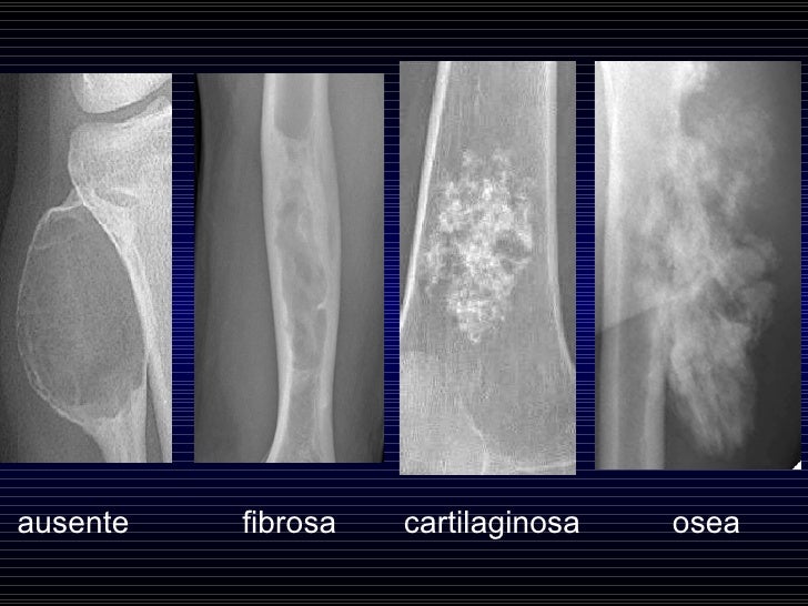 Clase Hueso Dr Figueroa Radiologia
