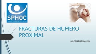 FRACTURAS DE HUMERO
PROXIMAL
DR CRISTIAN BOVEDA
 