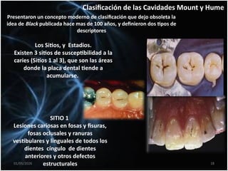Mount Home Classification System Comprehensive Guide to Class I Cavity Preparations in Dentistry | PPTX