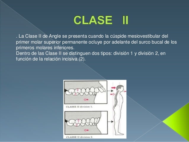Clase ii