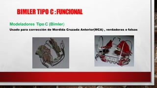 BIMLER TIPO C:FUNCIONAL
Modeladores Tipo C (Bimler)
Usado para corrección de Mordida Cruzada Anterior(MCA) , verdaderas o falsas
 