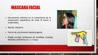 MASCARAFACIAL
 Herramienta efectiva en el tratamiento de la
maloclusión esquelética de clase III (leves a
moderadas)
 Maxilar retrusivo
 Patrón de crecimiento hipodivergente.
 Puede corregir problemas de mordidas cruzadas
dentales anteriores de 1 a 3 meses
 