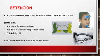 RETENCION
EXISTEN DIFERENTES APARATOS QUE PUEDEN UTILIZARSE PARA ESTE FIN
(entre ellos)
 Una placa de mantenimiento
 Uso de la máscara facial por las noches
 Fränkel tipo III
Esta fase se establece alrededor de 4-6 meses.
 