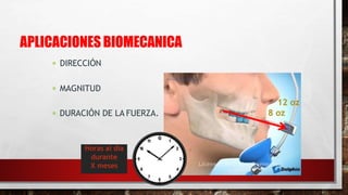 APLICACIONES BIOMECANICA
 DIRECCIÓN
 MAGNITUD
 DURACIÓN DE LA FUERZA.
12 oz
8 oz
Horas al día
durante
X meses
 