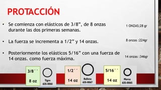 PROTACCIÓN
-
• Se comienza con elásticos de 3/8”, de 8 onzas
durante las dos primeras semanas.
• La fuerza se incrementa a 1/2” y 14 onzas.
• Posteriormente los elásticos 5/16” con una fuerza de
14 onzas. como fuerza máxima.
3/8´´
8 oz
1/2´´
14 oz
5/16´´
14 oz
1 ONZAS;28 gr
8 onzas :224gr
14 onzas :346gr
 