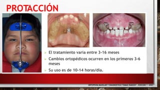 ORTOPEDIA MAXILAR Y DIAGNOSTICO TOMAS RAKOSY , EDICION 1 -2007
 El tratamiento varía entre 3-16 meses
 Cambios ortopédicos ocurren en los primeros 3-6
meses
 Su uso es de 10-14 horas/día.
PROTACCIÓN
 