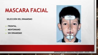 MASCARA FACIAL
SELECCIÓN DEL DINAMISMO
 FRONTAL
 MENTONIANO
 SIN DINAMISMO
ORTOPEDIA MAXILAR Y DIAGNOSTICO TOMAS RAKOSY , EDICION 1 -2007
 