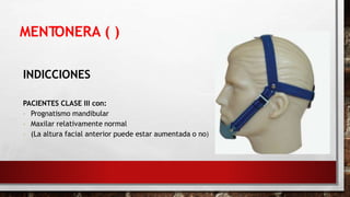 MENTONERA ( )
INDICCIONES
PACIENTES CLASE III con:
- Prognatismo mandibular
- Maxilar relativamente normal
- (La altura facial anterior puede estar aumentada o no)
 