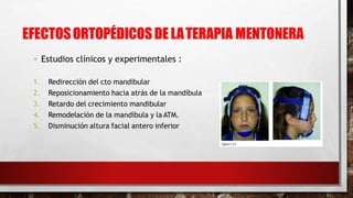 EFECTOSORTOPÉDICOSDELATERAPIA MENTONERA
 Estudios clínicos y experimentales :
1. Redirección del cto mandibular
2. Reposicionamiento hacia atrás de la mandíbula
3. Retardo del crecimiento mandibular
4. Remodelación de la mandíbula y la ATM.
5. Disminución altura facial antero inferior
 