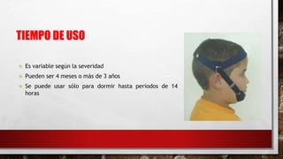 TIEMPO DE USO
 Es variable según la severidad
 Pueden ser 4 meses o más de 3 años
 Se puede usar sólo para dormir hasta periodos de 14
horas
 