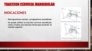  Retrognatismo maxilar y prognatismo mandibular
 Se puede utilizar la tracción cervical mandibular
como si fuera una mascara facial para protraer el
maxilar superior
TRACCION CERVICALMANDIBULAR
INDICACIONES
 