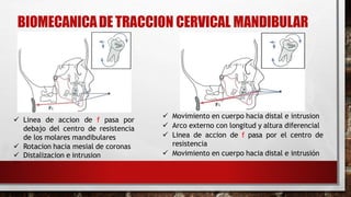 BIOMECANICADE TRACCION CERVICAL MANDIBULAR
 Linea de accion de f pasa por
debajo del centro de resistencia
de los molares mandibulares
 Rotacion hacia mesial de coronas
 Distalizacion e intrusion
 -
 Movimiento en cuerpo hacia distal e intrusion
 Arco externo con longitud y altura diferencial
 Linea de accion de f pasa por el centro de
resistencia
 Movimiento en cuerpo hacia distal e intrusión
 