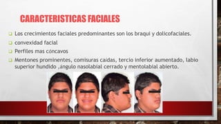  Los crecimientos faciales predominantes son los braqui y dolicofaciales.
 convexidad facial
 Perfiles mas cóncavos
 Mentones prominentes, comisuras caídas, tercio inferior aumentado, labio
superior hundido ,ángulo nasolabial cerrado y mentolabial abierto.
CARACTERISTICAS FACIALES
 