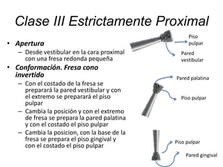 Clase III Estrictamente Proximal
• Apertura
– Desde vestibular en la cara proximal
con una fresa redonda pequeña
• Conformación. Fresa cono
invertido
– Con el costado de la fresa se
preparará la pared vestibular y con
el extremo se preparará el piso
pulpar
– Cambia la posición y con el extremo
de fresa se prepara la pared palatina
y con el costado el piso pulpar
– Cambia la posicion, con la base de la
fresa se prepara el piso gingival y
con el costado el piso pulpar
Pared
vestibular
Piso
pulpar
Pared palatina
Piso pulpar
Pared gingival
Piso pulpar
 