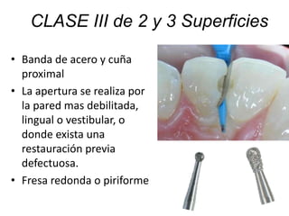 • Banda de acero y cuña
proximal
• La apertura se realiza por
la pared mas debilitada,
lingual o vestibular, o
donde exista una
restauración previa
defectuosa.
• Fresa redonda o piriforme
CLASE III de 2 y 3 Superficies
 