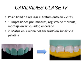 • Posibilidad de realizar el tratamiento en 2 citas
• 1. Impresiones preliminares, registro de mordida,
montaje en articulador, encerado
• 2. Matriz en silicona del encerado en superficie
palatina
CAVIDADES CLASE IV
 