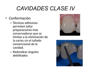 • Conformación
– Técnicas adhesivas
permiten tallar
preparaciones más
conservadoras que se
limitan a la eliminación de
la caries sin el tallado
convencional de la
cavidad.
– Redondear ángulos
debilitados
CAVIDADES CLASE IV
 