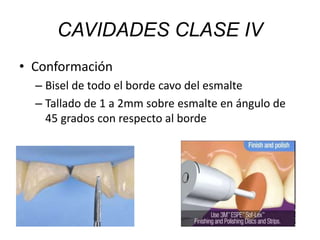 • Conformación
– Bisel de todo el borde cavo del esmalte
– Tallado de 1 a 2mm sobre esmalte en ángulo de
45 grados con respecto al borde
CAVIDADES CLASE IV
 