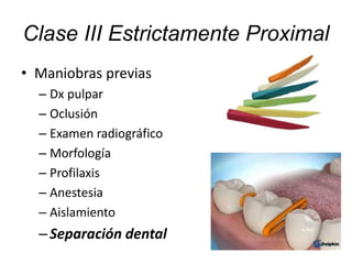 • Maniobras previas
– Dx pulpar
– Oclusión
– Examen radiográfico
– Morfología
– Profilaxis
– Anestesia
– Aislamiento
–Separación dental
Clase III Estrictamente Proximal
 