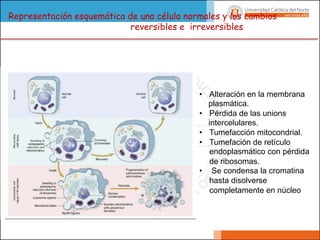 Representación esquemática de una célula normales y los cambios
reversibles e irreversibles
• Alteración en la membrana
plasmática.
• Pérdida de las unions
intercelulares.
• Tumefacción mitocondrial.
• Tumefación de retículo
endoplasmático con pérdida
de ribosomas.
• Se condensa la cromatina
hasta disolverse
completamente en núcleo
 