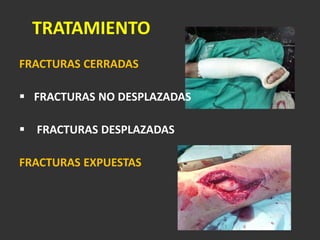 CTGCLASIFICACIÓN HUESO
