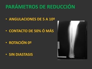CARACTERÍSTICAS CLÍNICAS