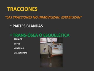   OBLICUO CORTOINESTABLESOBLICUO LARGO