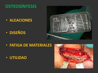 CONMINUTADESPLAZAMIENTO NO DESPLAZADASDESPLAZADASANTERO POSTERIOR