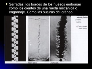  Serradas:los bordes de los huesos embonan
 como los dientes de una rueda mecánica o
 engranaje. Como las suturas del cráneo.
 