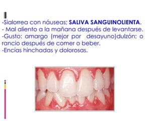 -Sialorrea con náuseas;  SALIVA SANGUINOLIENTA . - Mal aliento a la mañana después de levantarse.  -Gusto: amargo (mejor por  desayuno)dulzón; o rancio después de comer o beber.  -Encías hinchadas y dolorosas. 