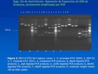 Foto: Gel de electroforesis. Separación de fragmentos de ADN de
         levaduras, previamente amplificados por PCR

               1 2 3 M 1 2 3 1 2 3 M 1 2 3 1 2 3 1     2 3 M




500 bp




              A       B      C        D      E     F



  Figure 2: RFLP of ITS1-NL4 regions. Lanes: 1, S. cerevisiae ATCC 32052; 2, ASM III;
  3, C. tropicalis ATCC 20311. A, undigested PCR products; B, BspdI digested PCR
  products; C, SspI digested PCR products; D, EcoRI digested PCR products; E, BamHI
  digested PCR products; F, HaeIII digested PCR products; M, molecular weight marker
  100 bp DNA Ladder.
 