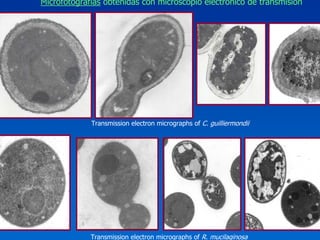 Microfotografías obtenidas con microscopio electrónico de transmisión




             Transmission electron micrographs of C. guilliermondii




             Transmission electron micrographs of R. mucilaginosa
 