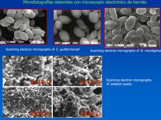 Microfotografías obtenidas con microscopio electrónico de barrido




Scanning electron micrographs of C. guilliermondii   Scanning electron micrographs of R. mucilaginosa




                                                               Scanning electron micrographs
                                                               of isolated yeasts
 