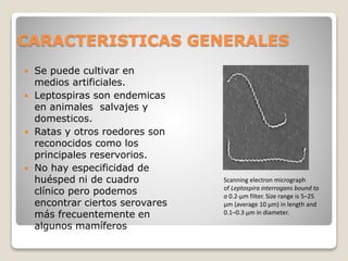 CARACTERISTICAS GENERALES
 Se puede cultivar en
medios artificiales.
 Leptospiras son endemicas
en animales salvajes y
domesticos.
 Ratas y otros roedores son
reconocidos como los
principales reservorios.
 No hay especificidad de
huésped ni de cuadro
clínico pero podemos
encontrar ciertos serovares
más frecuentemente en
algunos mamíferos
Scanning electron micrograph
of Leptospira interrogans bound to
a 0.2-μm filter. Size range is 5–25
μm (average 10 μm) in length and
0.1–0.3 μm in diameter.
 