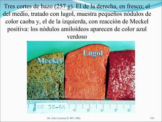 Dr. Julio Larenas H. MV, MSc Tres cortes de bazo (257 g). El de la derecha, en fresco; el del medio, tratado con lugol, muestra pequeños nódulos de color caoba y, el de la izquierda, con reacción de Meckel positiva: los nódulos amiloídeos aparecen de color azul verdoso 