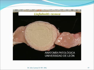 Dr. Julio Larenas H. MV, MSc Linfadenitis caseosa 