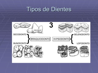 Tipos de Dientes
 
