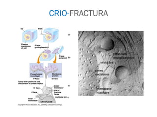 CRIO-FRACTURA
 