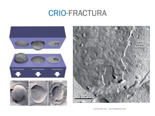 CRIO-FRACTURA
 