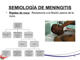 SEMIOLOGÌA DE MENINGITIS
• Rigidez de nuca: Resistencia a la flexión pasiva de la
nuca.
12
 