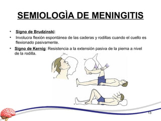 SEMIOLOGÌA DE MENINGITIS
• Signo de Brudzinski:
• Involucra flexión espontánea de las caderas y rodillas cuando el cuello es
flexionado pasivamente.
13
• Signo de Kernig: Resistencia a la extensión pasiva de la pierna a nivel
de la rodilla.
 