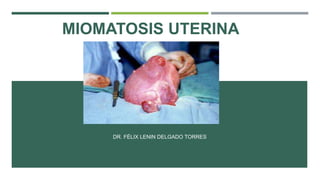 MIOMATOSIS UTERINA
DR. FÉLIX LENIN DELGADO TORRES
 