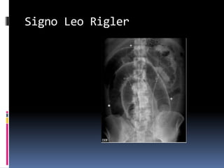 rx simple de torax y abdomen | PPTX
