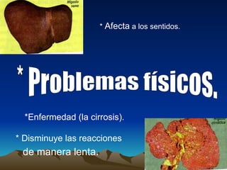 * Problemas físicos. *  Afecta  a los sentidos. * Disminuye las reacciones de manera lenta. *Enfermedad (la cirrosis). 