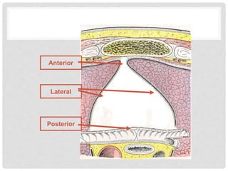 Posterior
Anterior
Lateral
 