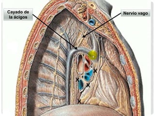 Cayado de
la ácigos
Nervio vago
 