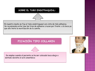 SOBRE EL TUBO ENDOTRAQUEAL:




En nuestro medio se fija el tubo endotraqueal con cinta de tela adhesiva.
Se recomienda evitar que las tiras de adhesivo crucen por frente a la boca ya
que ello limita la movilización de la camilla.




               FIJACIÓN TIPO COLLARIN




 Se emplea cuando el paciente va ha ser colocado boca abajo o
sentado durante el acto anestésico
 