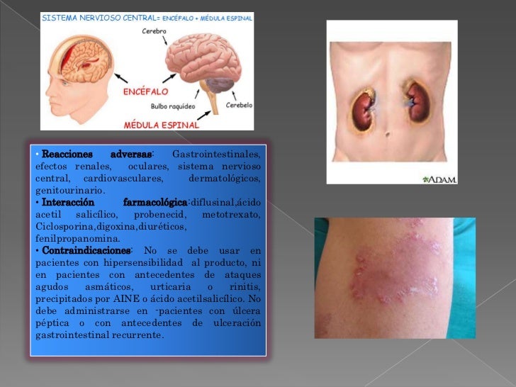 Prednisone cost without insurance cvs