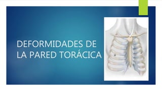 DEFORMIDADES DE
LA PARED TORÁCICA
 